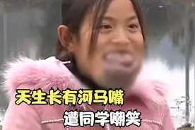 女孩天生长有河马嘴，遭同学嘲笑只能默默承受，父母：求放过视频封面