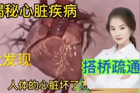 医学演绎 人体心脏血管堵塞 心血管疾病 如何疏通搭桥 看视频视频封面