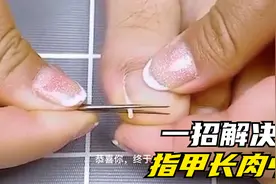 嵌甲、指甲长到肉中很难受，一招教你解决趾甲长肉里的问题视频封面
