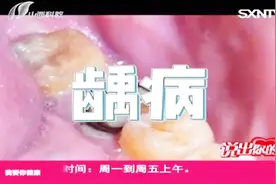 说出你的爱：原来一天之中这个时间最适合刷牙，听专家讲理由视频封面