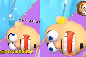 一起掏耳朵：今天来帮同学们挖耳朵了，这是多久没有清理了视频封面