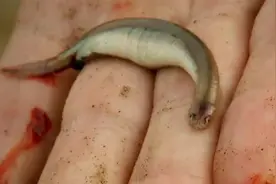 别在河里尿尿，当心窜进膀胱，让你生不如死！视频封面
