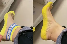 女子夜市买新袜子，穿一天后脚底板被染成黄色洗不掉，结局亮了！视频封面