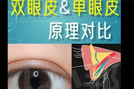 单眼皮和双眼皮的区别视频封面