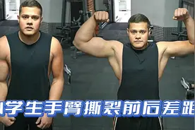 小学生肱二头肌撕裂后，前后对比差距大，日常训练这四个动作！视频封面
