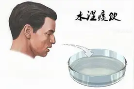 中医如何治咳嗽、咳喘？国医大师解读《金匮要略》对痰饮病的治疗视频封面