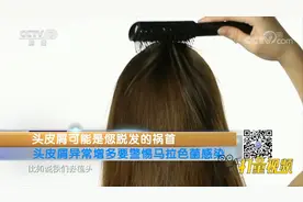 头皮屑可能是脱发的祸首！头皮屑增多警惕马拉色菌感染|生活提示视频封面