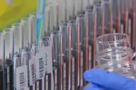 美国18家情报机构参与报告 唯一共识是“新冠并非生物武器”视频封面