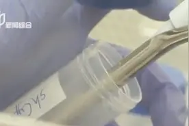 艾滋病治疗再现奇迹!“伦敦病人”或有救,将成艾滋病被治愈第二人视频封面