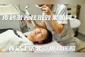 皮秒激光祛斑效果怎么样？三周真实记录！真记走访北京协和医院视频封面