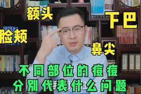 额头脸颊下巴鼻头，不同部位的痘痘分别代表什么问题？医生教你治