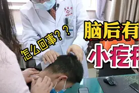 孩子脑袋后面长了个小疙瘩，是怎么回事？视频封面