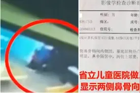安徽一3岁娃鼻子被幼师打成轻微伤，其他孩子也遭老师打骂被烫伤视频封面