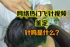 【中医鉴定】方氏头皮飞针的魅力！视频封面