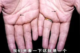 五线又叫玉柱线，经常深呼吸调节呼吸系统功能，运动员很少长五线视频封面