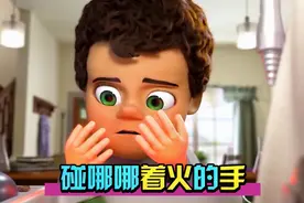 男孩手掌温度高达几千度，碰到铁夹子都瞬间融化视频封面