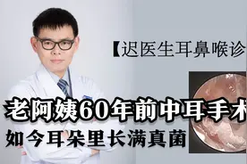 【迟医生耳鼻喉诊室】老阿姨60年前中耳手术，如今长满真菌视频封面