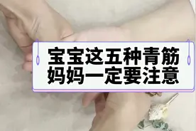 宝宝面部这五种青筋，宝妈一定要注意视频封面
