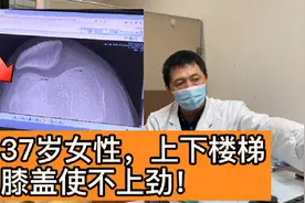 膝盖发软，上下楼梯无力？医生：你可能是髌骨有问题啦！视频封面