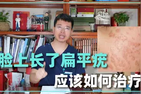 脸上长了扁平疣怎么办？医生说：这些方法能“消灭”它们！视频封面