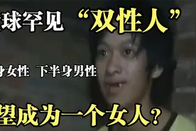全球罕见“双性人”，半男半女雌雄同体，却及其渴望变成女人！视频封面