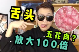舌头用显微镜放大100倍看上去像块五花肉！好玩的微观世界视频封面