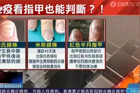 看指甲就知道是否确诊？医师揭感染新冠肺炎“4大特征”！视频封面