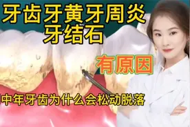 中人群牙齿为什么会发黄衰退松动脱落 日常生活如何预防方法重要视频封面