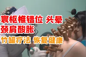 寰枢椎错位，头晕，颈肩酸胀，竹罐疗法，看见疗效视频封面