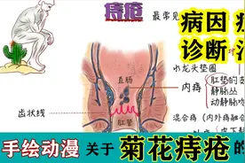 医学动漫|为什么会得痔疮？病因+机制+症状+有效治疗全攻略视频封面