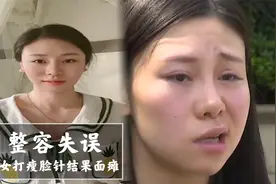 美女打瘦脸针面瘫，脸歪嘴斜不能喝水，医生：可能终生无法恢复视频封面