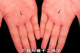 手掌纹十二线代表着肝损伤，十三线代表着免疫性疾病视频封面