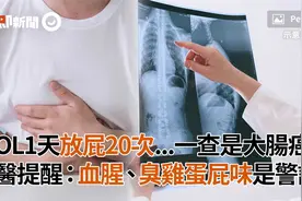 OL1天放屁20次！一查是大肠癌 医提醒：血腥、臭鸡蛋屁味是警讯视频封面