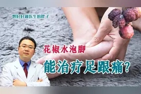 花椒水泡脚能治疗足跟痛？医生辟谣，建议选择正规疗法，别选调料视频封面