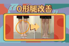 并不拢的腿最难看，一个动作改善O型腿，每天这样坐坐就可以了视频封面