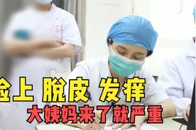 脸上脱皮发痒，一来大姨妈就严重，一年多反反复复看不好视频封面