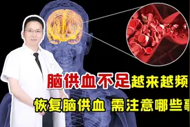 脑供血不足、总是头晕头痛？医生介绍五种改善方法，恢复血管弹性视频封面