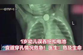 1岁幼儿误吞纽扣电池，食道穿孔情况危急！医生：危及生命视频封面