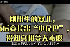 刚出生的婴儿，背后竟长出“小尾巴”，得知真相令人心酸视频封面