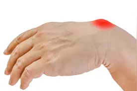 手腕上长了肿包怎么办？教你3种治疗方法，快速消除腱鞘囊肿视频封面