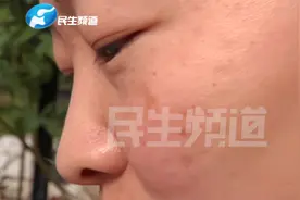 女子爱美去打面部水光针，不料打完针满脸“针眼”肿的没眼看……视频封面
