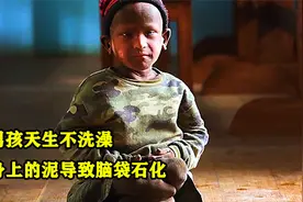 男孩天生不洗澡，身上的泥导致脑袋石化视频封面