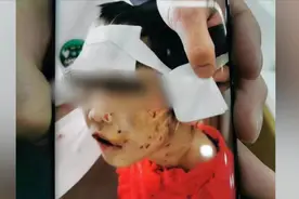 黑龙江警方介入4岁女童疑遭虐待重伤，邻居：大冬天孩子被关室外视频封面