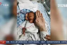 广州：出生仅一斤多 超早产“巴掌宝宝”奇迹存活视频封面