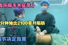 「腰腹环吸手术实录」120分钟抽出2100毫升脂肪，细节决定效果