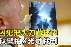美国鹈鹕湾监狱，囚犯把尖刀藏进体内，狱警拍X光才找到视频封面