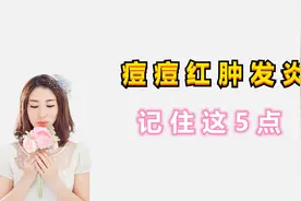 痘痘红肿发炎怎么办？记住这5点，告别痘痘肌视频封面