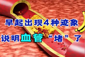 晨起出现4种迹象，或是血管“堵塞”了，一个不占，值得恭喜视频封面