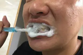 去除牙垢原来这么简单，教你这样刷牙，牙黄牙垢彻底清除干净视频封面