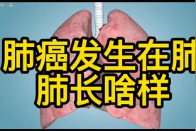 肺癌、肺结节发生在肺，肺长啥样？外科医生通过3D解剖讲解视频封面